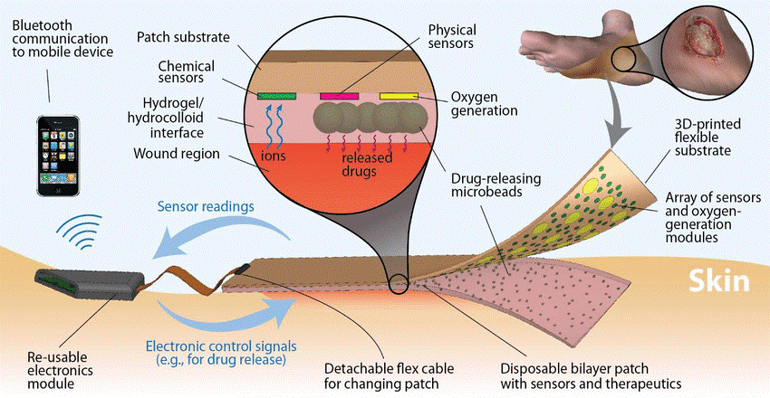 Figure 2: A manufacturable smart dressing with oxygen delivery and sensing capability for chronic wound management [4]